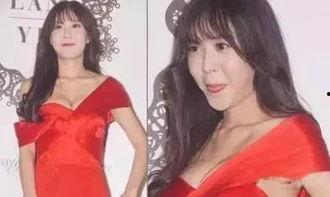 美嘉整形后的照片,惊艳蜕变，重拾自信风采